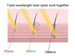  Диодный лазер для удаления волос FG2000-D 